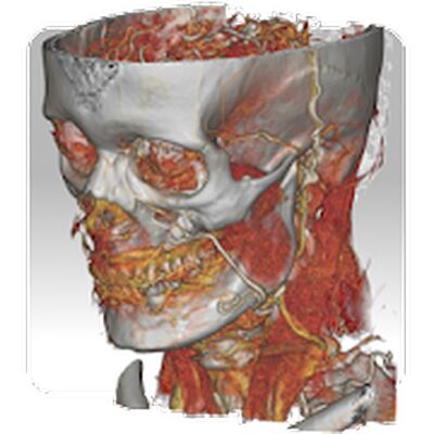 Скачать DroidRender - 3D DICOM viewer [Unlocked] RU apk на Андроид