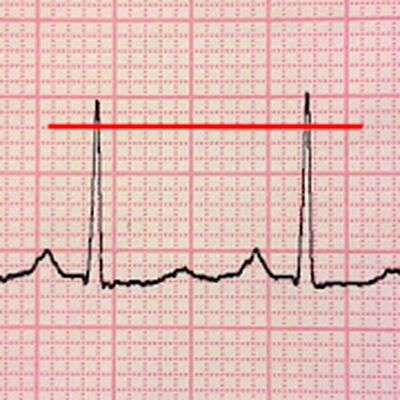 Скачать ECG Reader free [Premium] RUS apk на Андроид