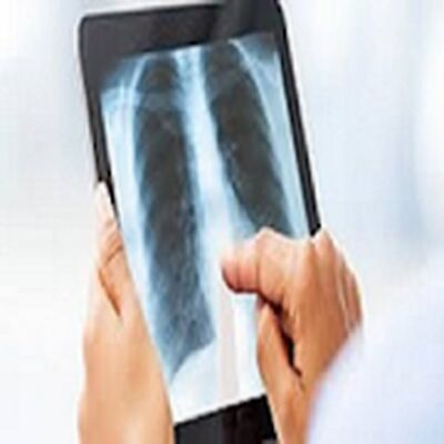 Скачать X-Ray Interpretation Guide [Полная версия] RUS apk на Андроид