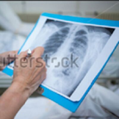 Скачать Chest X-Ray Based Cases [Без рекламы] RUS apk на Андроид
