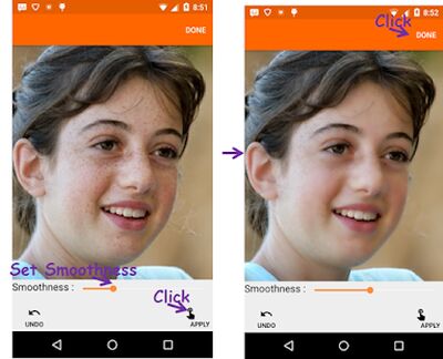 Скачать Угри Remover Photo Editor [Полная версия] RUS apk на Андроид