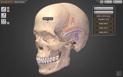 Скачать BoneBox™ - Skull Viewer [Без рекламы] RUS apk на Андроид