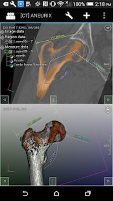 Скачать DroidRender - 3D DICOM viewer [Unlocked] RU apk на Андроид