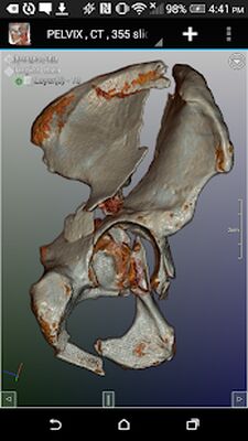 Скачать DroidRender - 3D DICOM viewer [Unlocked] RU apk на Андроид