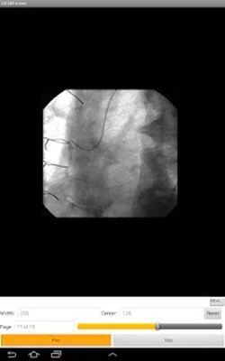 Скачать LEADTOOLS DICOM Viewer App [Unlocked] RU apk на Андроид