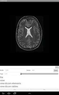 Скачать LEADTOOLS DICOM Viewer App [Unlocked] RU apk на Андроид