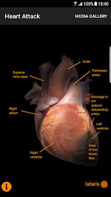 Скачать CardioSmart Heart Explorer [Полная версия] RU apk на Андроид