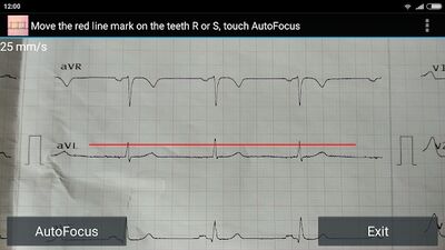 Скачать ECG Reader free [Premium] RUS apk на Андроид