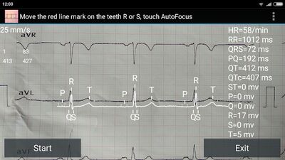 Скачать ECG Reader free [Premium] RUS apk на Андроид