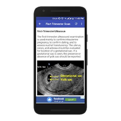 Скачать Obstetrics & Gyenacology Ultrasound Guide [Полная версия] RU apk на Андроид