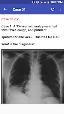 Скачать Chest X-Ray Based Cases [Без рекламы] RUS apk на Андроид