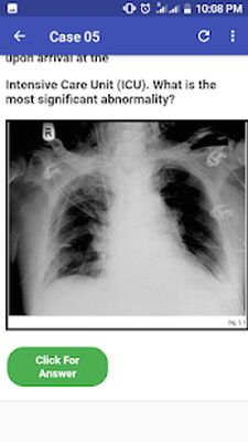 Скачать Chest X-Ray Based Cases [Без рекламы] RUS apk на Андроид