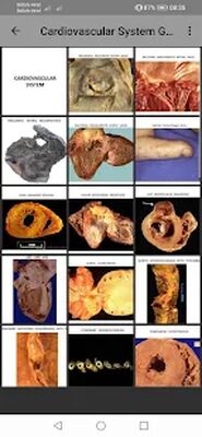 Скачать Pathology Atlas Professional [Полная версия] RUS apk на Андроид