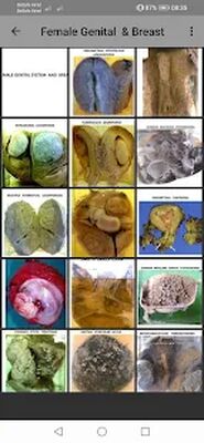 Скачать Pathology Atlas Professional [Полная версия] RUS apk на Андроид