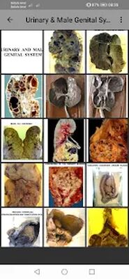 Скачать Pathology Atlas Professional [Полная версия] RUS apk на Андроид