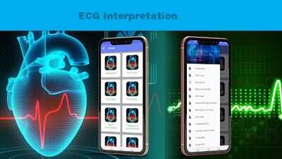 Скачать ECG Interpretation Guide [Полная версия] RUS apk на Андроид