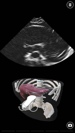 Скачать взломанную Deepscope Ultrasound Simulator [Мод меню] MOD apk на Андроид