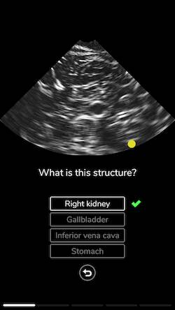 Скачать взломанную Deepscope Ultrasound Simulator [Мод меню] MOD apk на Андроид